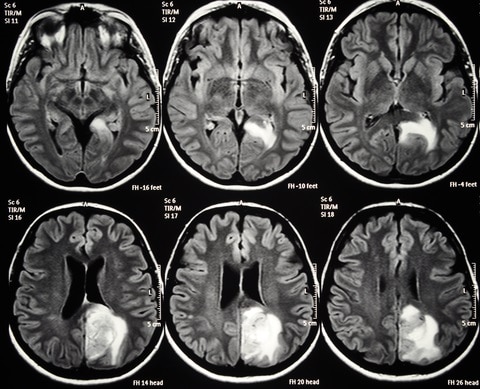 Brain MRI Image Classifier